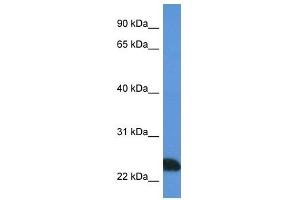 Western Blot showing PRSS1 antibody used at a concentration of 1 ug/ml against Jurkat Cell Lysate (PRSS1 抗体  (N-Term))