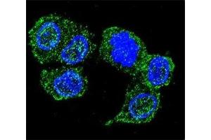 Confocal immunofluorescent analysis of JNK1 antibody with HepG2 cells followed by Alexa Fluor 488-conjugated goat anti-rabbit lgG (green). (JNK 抗体  (AA 358-389))