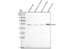 Western blot analysis of RBM22 using anti-RBM22 antibody (AZQ6NZZ9).