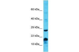 Host: Rabbit Target Name: MS4A6E Sample Type: Jurkat Whole Cell lysates Antibody Dilution: 1. (MS4A6E 抗体  (Middle Region))