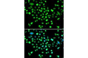 Immunofluorescence analysis of MCF-7 cells using PRK antibody (ABIN6132517, ABIN6146187, ABIN6146188 and ABIN6223135). (PRKAG1 抗体  (AA 1-331))