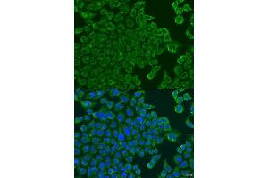 Immunofluorescence analysis of U2OS cells using ALOXE3 antibody. (ALOXE3 抗体  (AA 1-280))