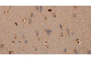 Immunohistochemistry of paraffin-embedded Human brain tissue using PLXNA1 Polyclonal Antibody at dilution 1:30 (Plexin A1 抗体)