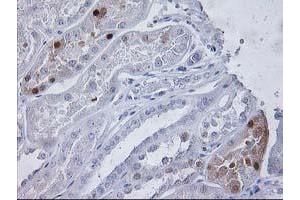 Immunohistochemical staining of paraffin-embedded Human Kidney tissue using anti-PGAM2 mouse monoclonal antibody. (PGAM2 抗体)