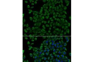 Immunofluorescence analysis of U2OS cells using TCN2 Polyclonal Antibody (TCN2 抗体)