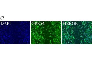 KP inhibits trophoblast migration. (KISS1R 抗体  (C-Term))