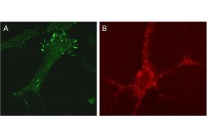 A: Indirect immunolabeling of NHF cells (dilution 1 : 100). (SDCBP 抗体)