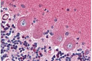 Human Brain, Cerebellum (formalin-fixed, paraffin-embedded) stained with GRIA2 antibody ABIN351533 at 1:50 followed by biotinylated anti-mouse IgG secondary antibody ABIN481714, alkaline phosphatase-streptavidin and chromogen. (GRIA2 抗体  (AA 175-430))