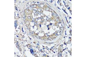 Immunohistochemistry (IHC) image for anti-Vesicle-Associated Membrane Protein 2 (Synaptobrevin 2) (VAMP2) (AA 1-100) antibody (ABIN1513674)
