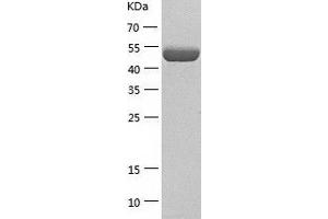 CNDP2 Protein (AA 1-475) (His tag)