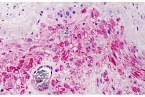Human Placenta: Formalin-Fixed, Paraffin-Embedded (FFPE) (COPB2 抗体  (AA 494-511))