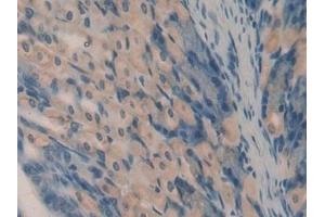Detection of OCM in Mouse Stomach Tissue using Polyclonal Antibody to Oncomodulin (OCM) (Oncomodulin 抗体  (AA 1-109))