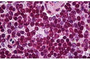 Human Spleen: Formalin-Fixed, Paraffin-Embedded (FFPE) (SOX10 抗体)