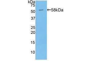 Western blot analysis of recombinant Mouse PAPPA. (PAPPA 抗体  (AA 999-1272))
