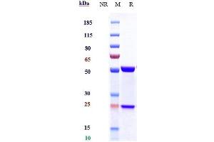 Anti-IL-6 / IFNb2 Reference Antibody (siltuximab) on SDS-PAGE under reducing (R) condition. (Recombinant IL6 (Siltuximab Biosimilar) 抗体)