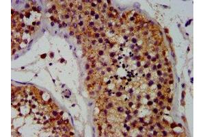 Immunohistochemistry (IHC) image for anti-POU Class 5 Homeobox 1 (POU5F1) (AA 1-360) antibody (ABIN7164068)