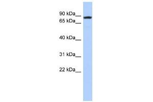 WB Suggested Anti-LOC81691 Antibody Titration: 0. (LOC81691 抗体  (Middle Region))