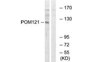 Western blot analysis of extracts from K562 cells, using POM121 Antibody. (POM121 抗体  (AA 1197-1246))