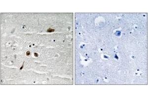Immunohistochemistry analysis of paraffin-embedded human brain, using MDC1 (Phospho-Ser513) Antibody. (MDC1 抗体  (pSer513))