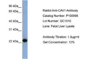 WB Suggested Anti-CAV1  Antibody Titration: 0. (Caveolin-1 抗体  (N-Term))