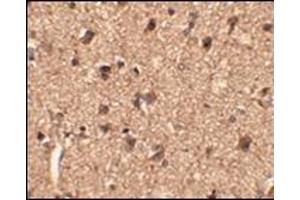 Immunohistochemistry of Slitrk1 in human brain tissue with this product at 2. (SLITRK1 抗体  (Middle Region))