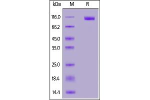 MERS S1 protein, His Tag on  under reducing (R) condition. (MERS-Coronavirus Spike Protein (AA 18-751) (His tag))
