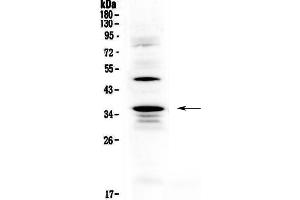 Western blot analysis of CD40L using anti-CD40L antibody .