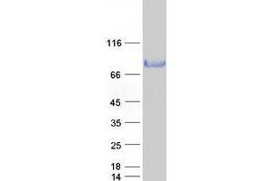 Validation with Western Blot