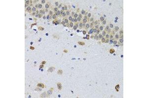 Immunohistochemistry of paraffin-embedded mouse brain using CIRBP antibody. (CIRBP 抗体  (AA 1-172))