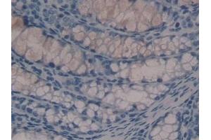 Detection of HDC in Mouse Colon Tissue using Polyclonal Antibody to Histidine Decarboxylase (HDC) (HDC 抗体  (AA 341-597))