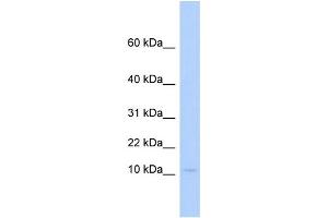 WB Suggested Anti-PLAC9 Antibody Titration:  0. (PLAC9 抗体  (Middle Region))