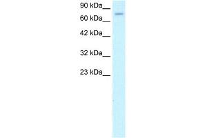 WB Suggested Anti-ZFP95 Antibody Titration: 1. (ZKSCAN5 抗体  (N-Term))