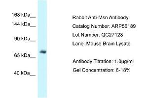 Western Blotting (WB) image for anti-Moesin (MSN) (C-Term) antibody (ABIN971193) (Moesin 抗体  (C-Term))