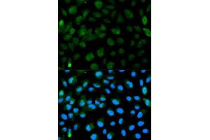 Immunofluorescence analysis of HeLa cell using PML antibody. (PML 抗体  (AA 300-600))