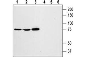 Western blot analysis of rat RBL basophilic leukemia (lanes 1 and 4), human HL-60 promyelocytic leukemia (lanes 2 and 5), and human Jurkat T-cell leukemia (lanes 3 and 6) cell lysates: - 1,2,3. (STIM1 抗体  (Extracellular, N-Term))