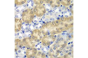 Immunohistochemistry of paraffin-embedded mouse kidney using AMY1A antibody. (AMY1A 抗体)