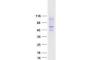 Western Blotting (WB) image for Platelet-Activating Factor Acetylhydrolase 1b, Regulatory Subunit 1 (45kDa) (PAFAH1B1) protein (Myc-DYKDDDDK Tag) (ABIN2728138)