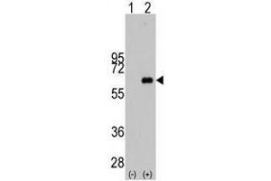 Image no. 1 for anti-Myc Proto-Oncogene protein (MYC) antibody (ABIN357362) (c-MYC 抗体)