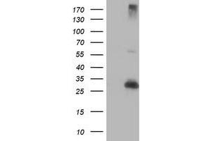 Western Blotting (WB) image for anti-Regulatory Factor X-Associated Ankyrin Containing Protein (RFXANK) antibody (ABIN1500679) (RFXANK 抗体)