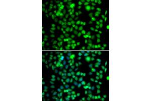 Immunofluorescence analysis of U2OS cells using FKBP6 antibody. (FKBP6 抗体)