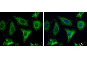 ICC/IF Image Fatty Acid Synthase antibody [N1N2], N-term detects Fatty Acid Synthase protein at cytoplasm by immunofluorescent analysis. (Fatty Acid Synthase 抗体  (N-Term))