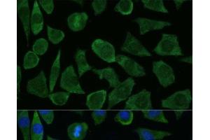 Immunofluorescence analysis of L929 cells using FKBP1B Polyclonal Antibody at dilution of 1:100 (40x lens). (FKBP1B 抗体)
