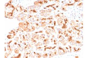 Formalin-fixed, paraffin-embedded human Pancreas stained with CFTR Rabbit Recombinant Monoclonal Antibody (CFTR/2290R). (Recombinant CFTR 抗体)