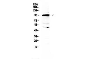 Western blot analysis of AMOTL2 using anti-AMOTL2 antibody . (AMOTL2 抗体  (AA 401-480))