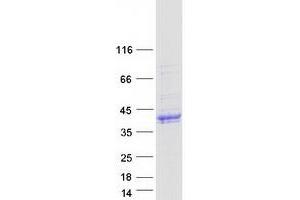 Western Blotting (WB) image for Mucosal Vascular Addressin Cell Adhesion Molecule 1 (MADCAM1) (Transcript Variant 2) protein (Myc-DYKDDDDK Tag) (ABIN2725141)