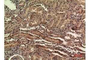Immunohistochemistry (IHC) analysis of paraffin-embedded Human Kidney, antibody was diluted at 1:100. (SDHB 抗体  (Internal Region))