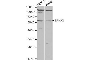Western blot analysis of extracts of various cell lines, using EPXH2 antibody. (EPHX2 抗体)