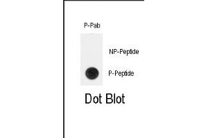 Dot blot analysis of anti-Phospho-TERT-p Antibody (ABIN390002 and ABIN2839778) on nitrocellulose membrane.