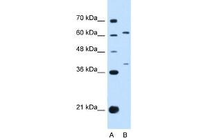 WB Suggested Anti-IL28RA Antibody Titration:  0. (IL28RA 抗体  (N-Term))