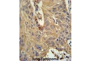 Immunohistochemistry (IHC) image for anti-Interleukin 5 Receptor, alpha (IL5RA) antibody (ABIN3002275) (IL5RA 抗体)